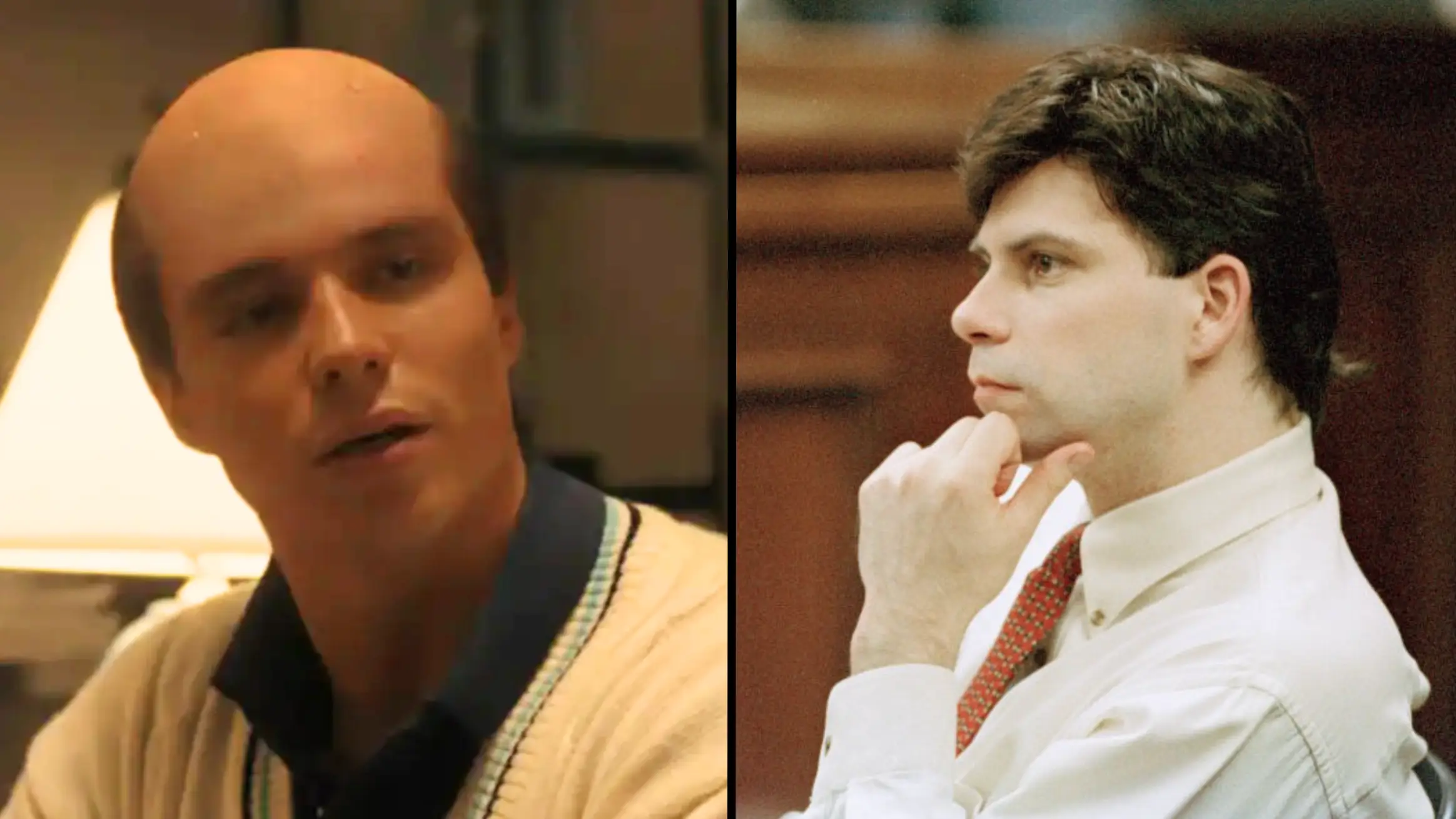 Truth behind whether Lyle Menendez lost his hair as shown in